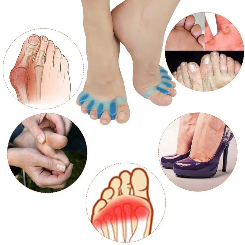 Gel Toe Separators & Bunion Correctors (2-Pack)